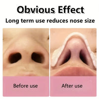 Breathable Thermoplastic Nose Lift & Corrector