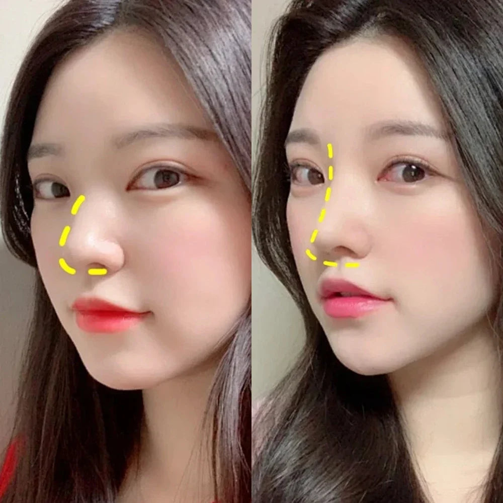 Breathable Thermoplastic Nose Lift & Corrector
