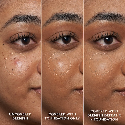 Fenty Skin Blemish Defeat'r BHA Spot-Targeting Gel