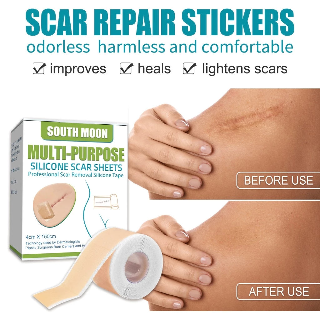Reusable Medical-Grade Silicone Scar Strips Roll