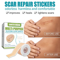 Reusable Medical-Grade Silicone Scar Strips Roll