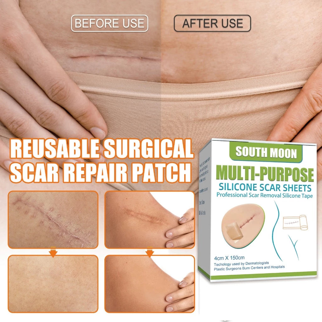 Reusable Medical-Grade Silicone Scar Strips Roll